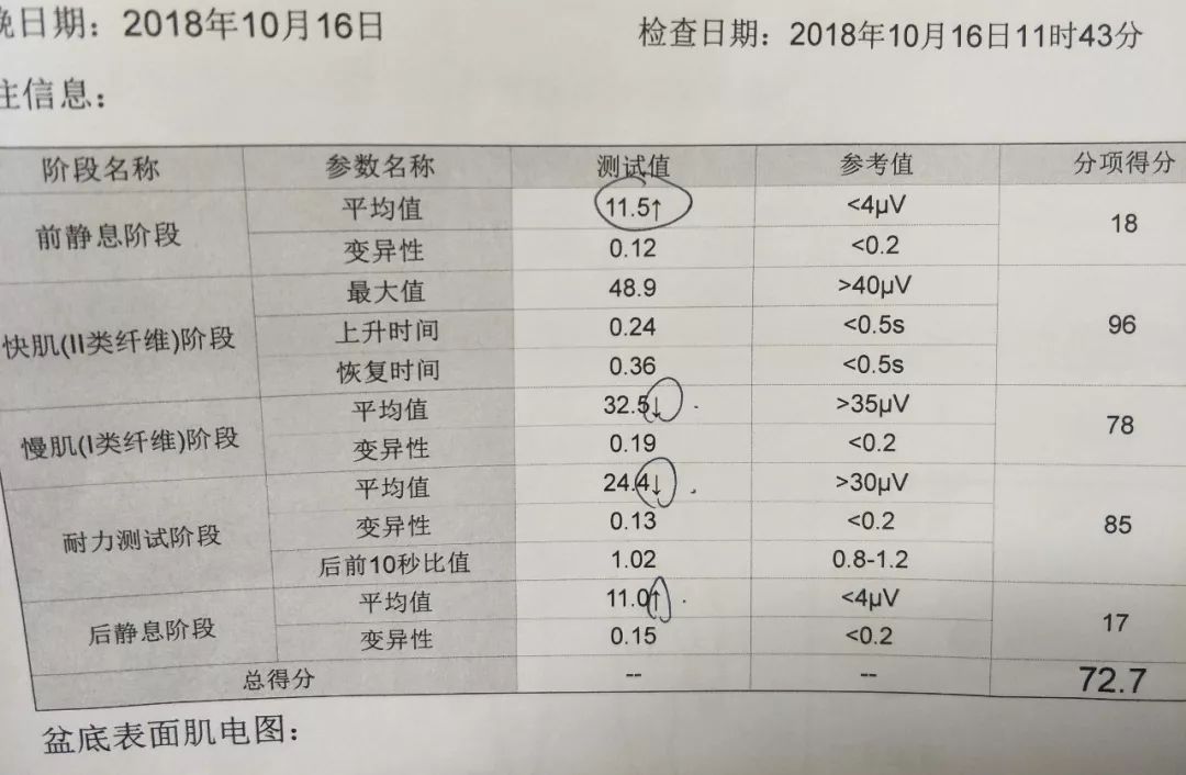 产后康复，疗效有图有真相—产后康复NO2