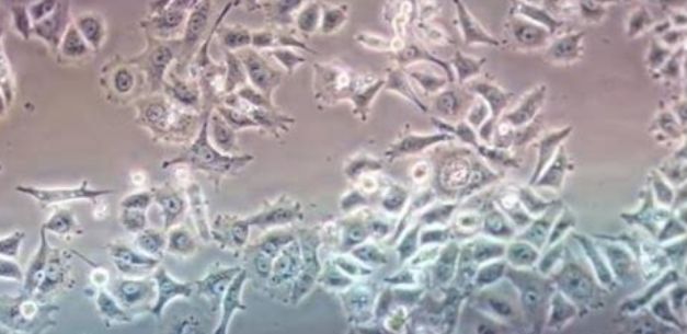 被污染的细胞,污染的细胞怎么处理