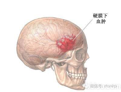 小不忍则乱大谋不可纠缠,小不忍则乱大谋不必理睬
