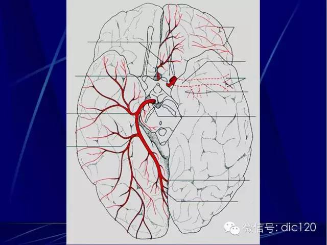 脑血管解剖技巧,脑血管解剖与介入