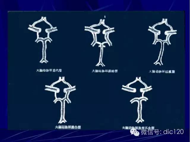 脑血管解剖技巧,脑血管解剖与介入