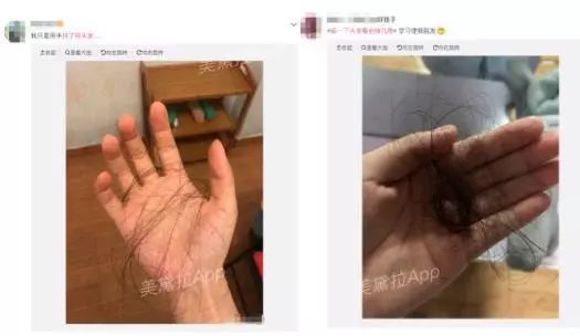 头等大事脱发青年自救指南,秃头女孩必看6大脱发误区