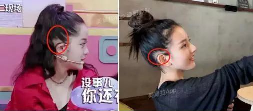 头等大事脱发青年自救指南,秃头女孩必看6大脱发误区