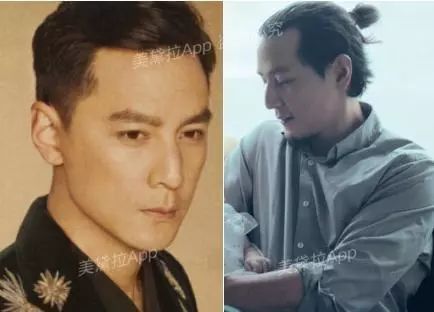 头等大事脱发青年自救指南,秃头女孩必看6大脱发误区