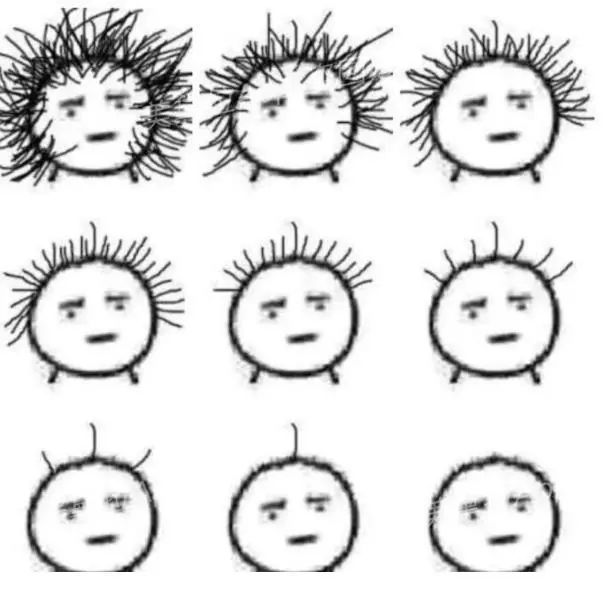 头等大事脱发青年自救指南,秃头女孩必看6大脱发误区