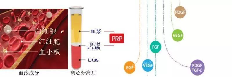 头等大事脱发青年自救指南,秃头女孩必看6大脱发误区