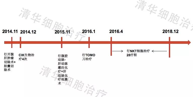 「肝胆管细胞癌，NKT治疗案例展示」清华NKT·乐和亲友2016-43