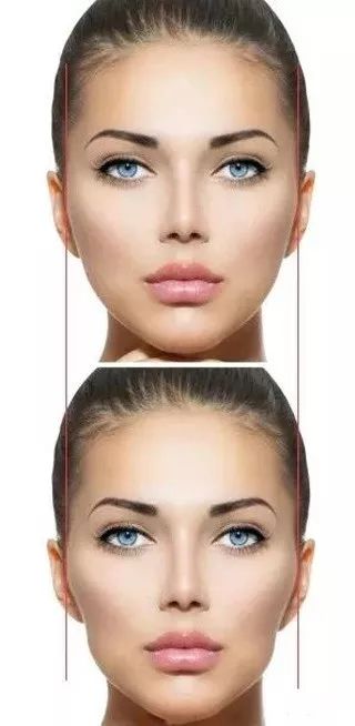 戴牙套换粗钢丝,拔四颗牙戴牙套的脸型变化图