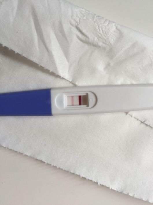 宫内孕合并宫外孕，医生护士协同作战降服病魔