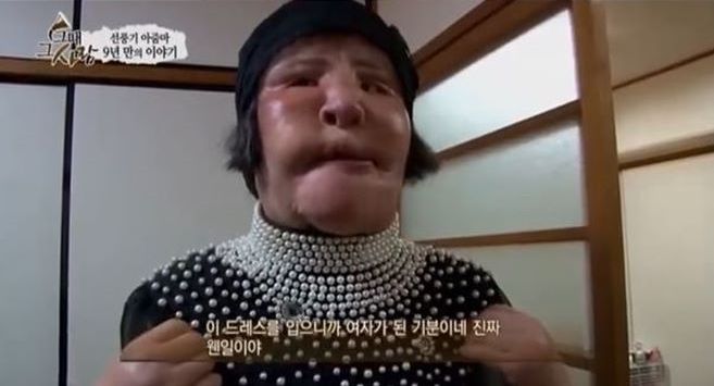 韩国整容毁容女逝去,整容电风扇大妈