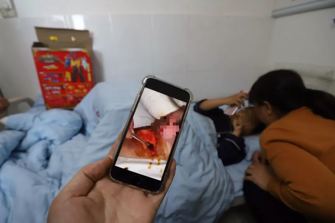 心疼小孩被烫伤,心疼孩子被烫