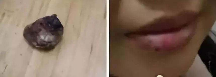 嘴唇起皮干裂能不能咬嘴唇,嘴唇起皮用手撕开了怎么办