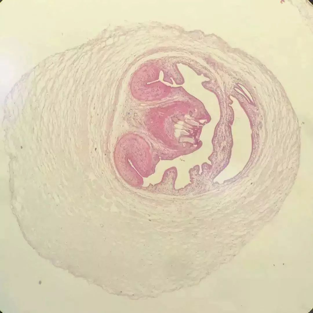 头皮上有个虫子,一女子头皮里有虫子