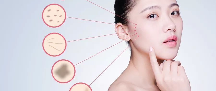 黑头挤完怎么处理,挤完黑头抹什么