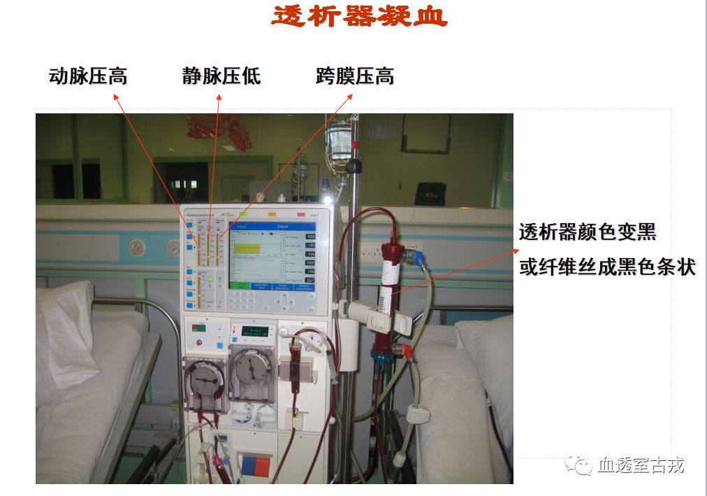 血液透析护理问题及措施,血液透析病人抢救原则