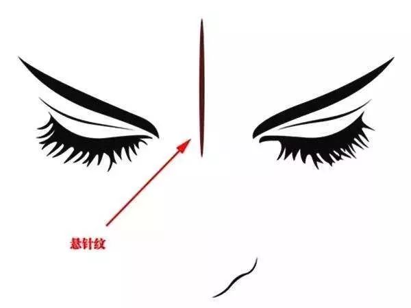 眉间纹抬头纹祛皱效果好吗,祛皱淡纹美容院