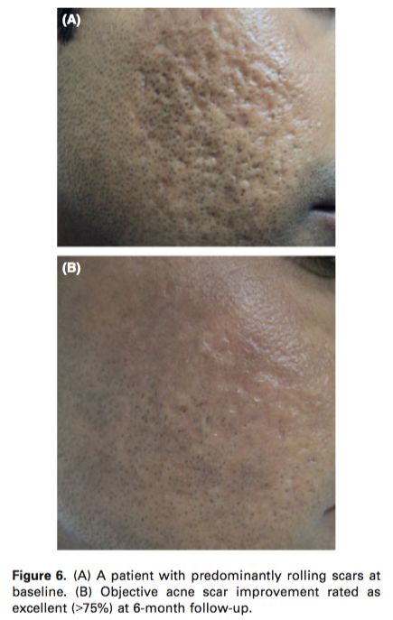 <html>
<head><title>502BadGateway</title></head>
<body>
<center><h1>502BadGateway</h1></center>
<hr><center>nginx</center>
</body>
</html>
<!--apaddingtodisableMSIEandChromefriendlyerrorpage-->
<!--apaddingtodisableMSIEandChromefriendlyerrorpage-->
<!--apaddingtodisableMSIEandChromefriendlyerrorpage-->
<!--apaddingtodisableMSIEandChromefriendlyerrorpage-->
<!--apaddingtodisableMSIEandChromefriendlyerrorpage-->
<!--apaddingtodisableMSIEandChromefriendlyerrorpage-->
