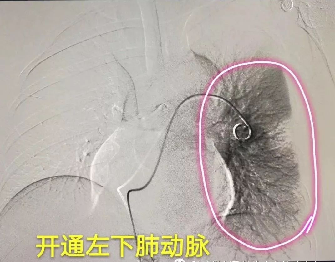 运城第一医院肿瘤介入科专家,运城市第一医院介入科专家