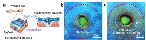 亲疏水复合敷料用于促进伤口愈合研究获进展