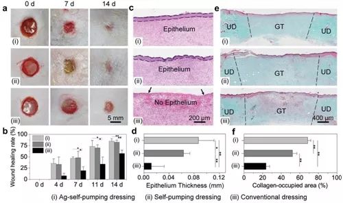 亲疏水复合敷料用于促进伤口愈合研究获进展