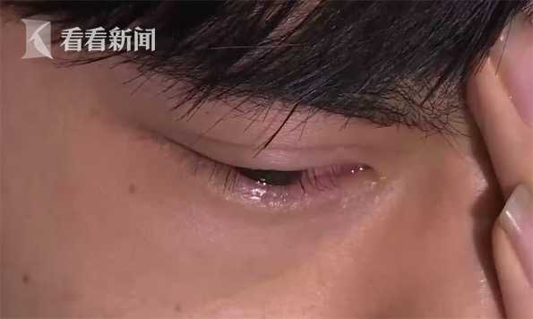 警惕男子玩雪花喷雾眼角膜被烧伤,男子用降温喷雾后点烟全身烧伤