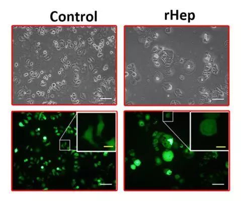逆转癌细胞，被中国科学家实现了！东方肝胆外科医院团队成功将肝癌细胞重编程，癌细胞回归正常细胞丨科学大发现