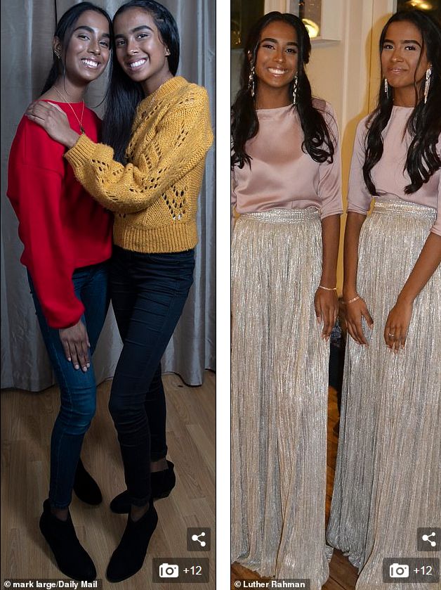 这对要上牛津剑桥的美女姐妹花，16年前是连体婴！存活率仅百万分之一