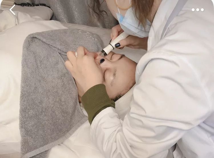 草莓鼻救星怎么治疗,草莓鼻去黑头神器视频