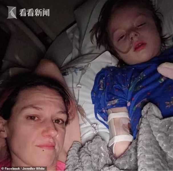 6岁小孩吞了圆形小磁铁,熊孩子贪玩吞钢珠磁铁