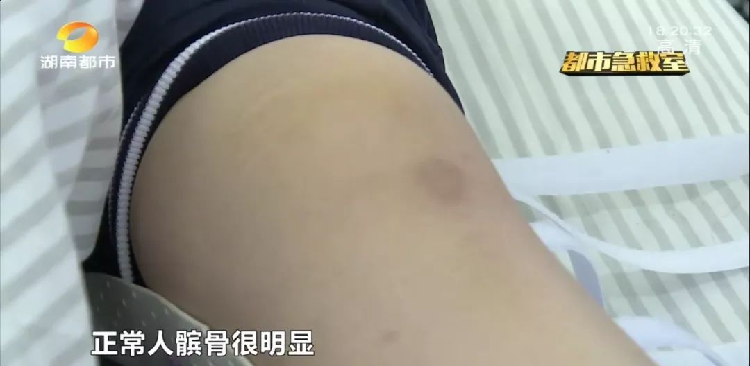 初中女生运动会跑步摔倒大哭,中考体育女生跑步摔倒