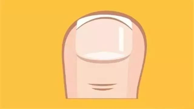 脚趾甲长进肉里不剪掉可以吗,脚趾甲长进肉里只剩一点掏不出来