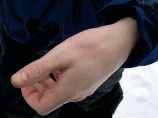 青年得癌症概率高吗,现代年轻人易得的病