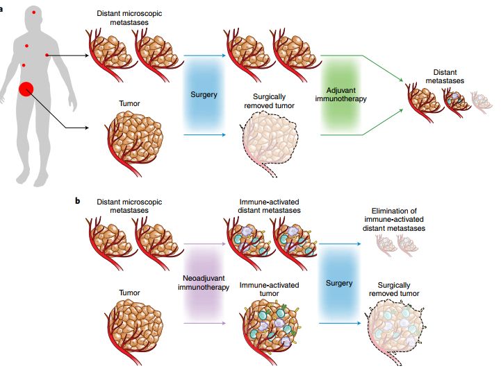 「我们都被结果惊呆了」：免疫新辅助治疗，正在改写早期肺癌的治疗现状，这无疑也是中国临床的新机遇丨奇点搜神记