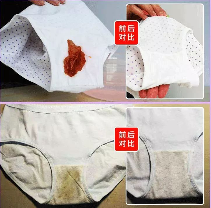 内裤变脏黄黑是什么病,裤子上有黄黄的东西是怎么回事