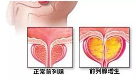 介入科普合集,介入健康科普短视频