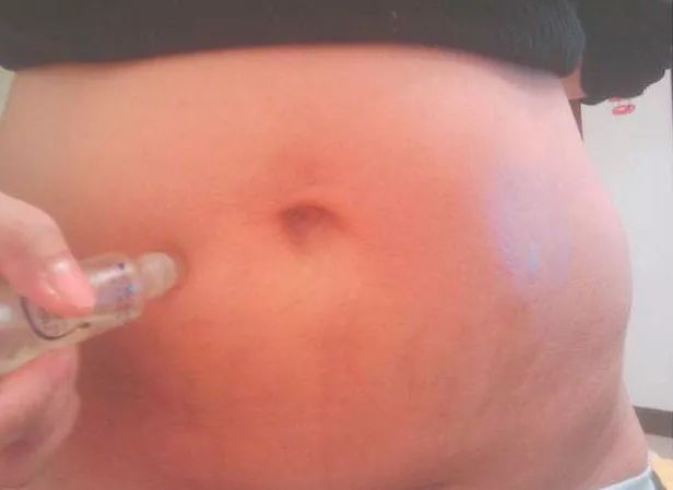 产后肚皮松垮做仰卧起坐有用吗,产后肚皮松垮皱巴巴怎么快速修复