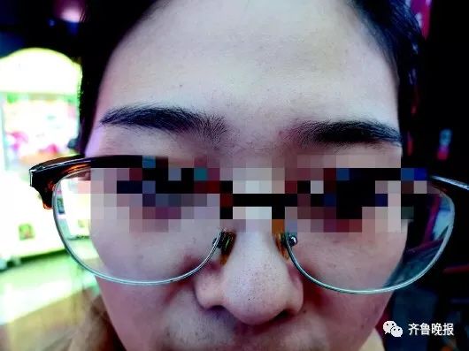 相信文眉开运，济南一女子花8.3万美容！却发现眉毛掉色嘴唇起皮