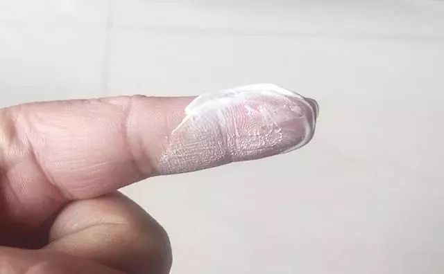 不用打磨牙齿的快速美白方法,不用洗牙能把牙垢黄牙变白的方法