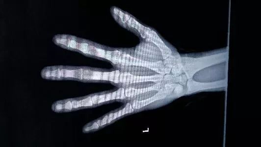 涨知识科普人体骨骼,骨龄鉴定可以改年龄吗