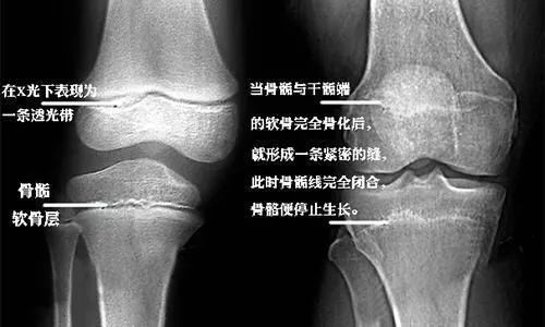 涨知识科普人体骨骼,骨龄鉴定可以改年龄吗