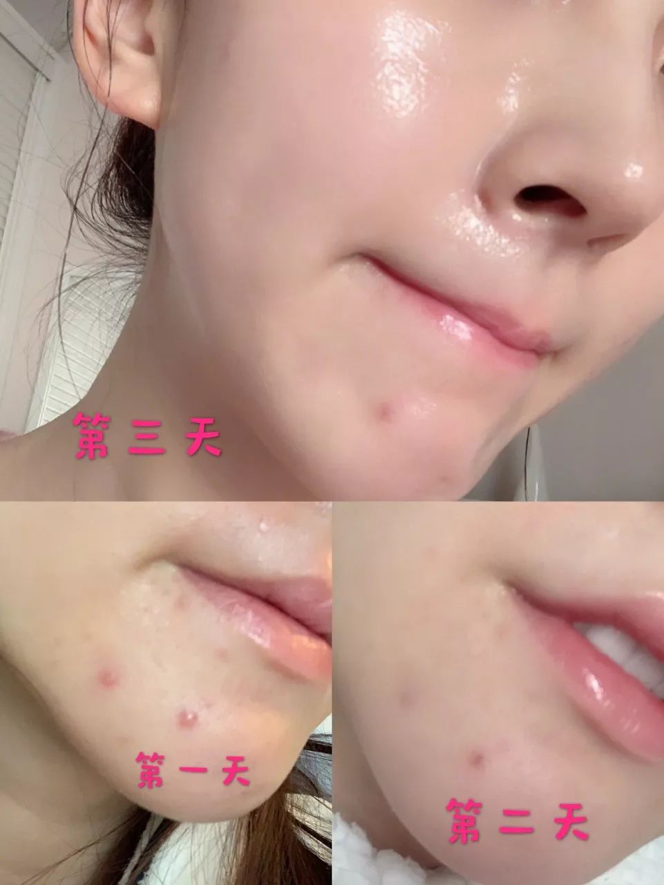 风很大的医美面膜真的好用么