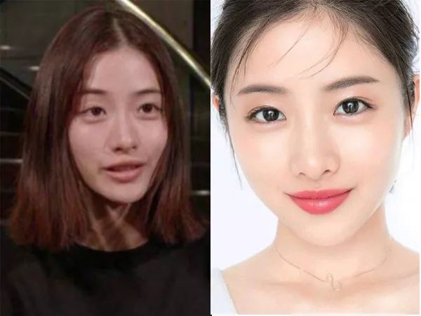 怎么样才能增加眉眼间距,眉眼距怎么通过锻炼改善