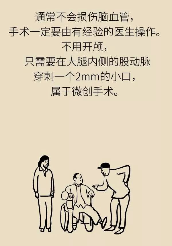 微针取血栓骗局视频,微针取血栓是国家认可吗