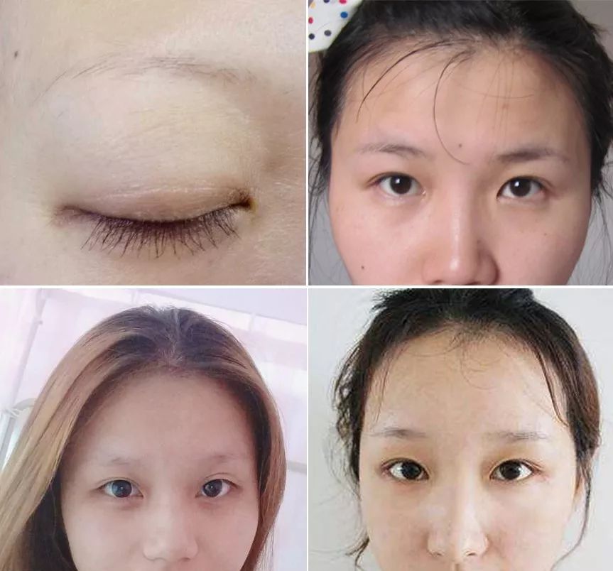 残眉修复,残眉画眉