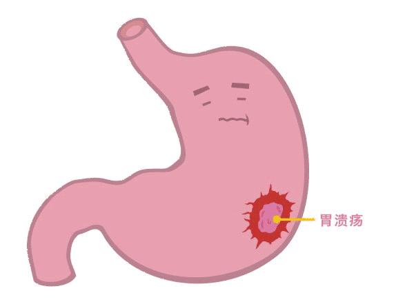 生活中有哪些常见凶险的致病菌,非常危险的致病菌有哪些