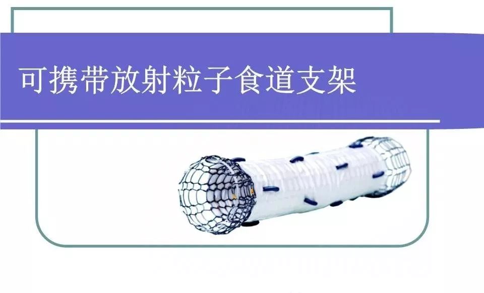 碘125粒子植入术适合哪类肿瘤,碘125粒子植入治癌