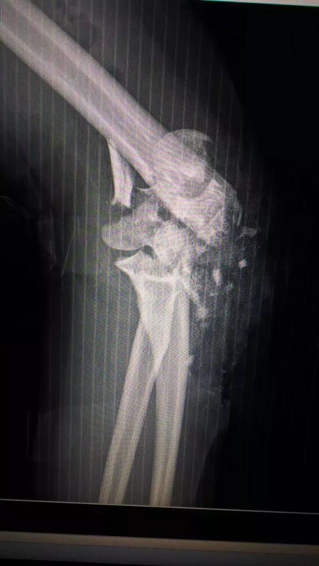 鍦ｅ痉鍥介檯鍖婚櫌楠ㄧ涓讳换,淇￠槼鍦ｅ痉鍖婚櫌楠ㄧ