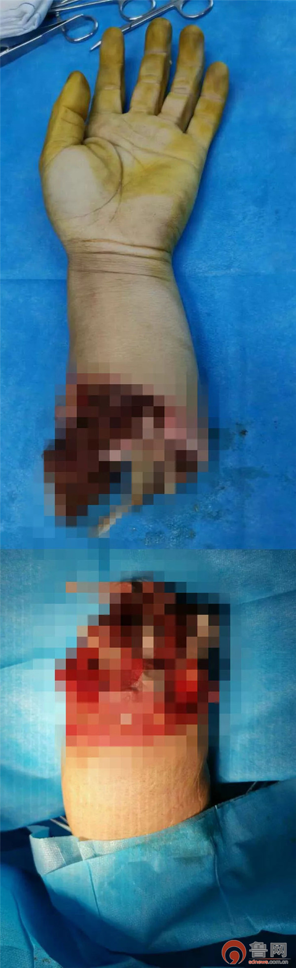 青岛郭先生,青岛即墨明亮手足外科医院