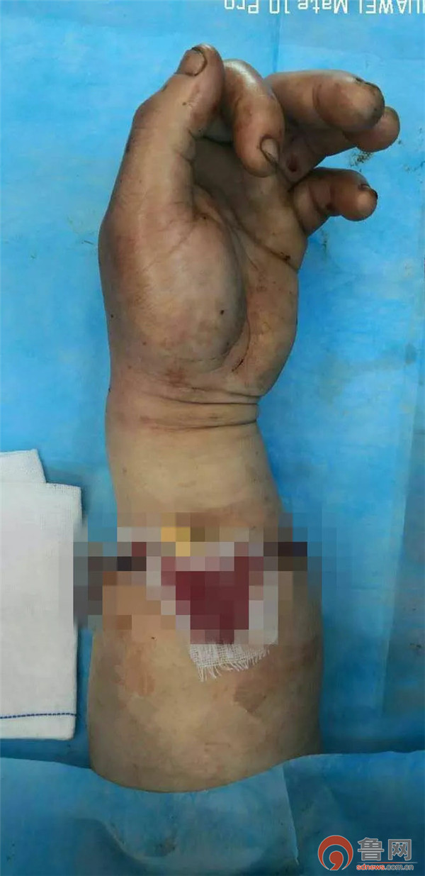 青岛郭先生,青岛即墨明亮手足外科医院