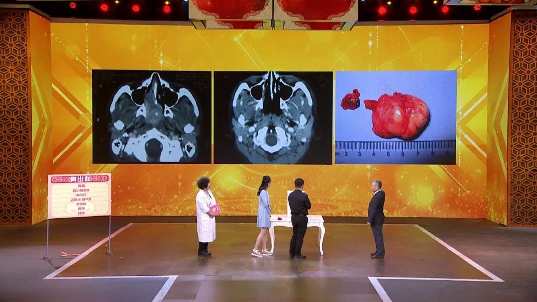 京医预告｜今晚17:25北京医院耳鼻喉科主任医师王晓云做客《养生堂》—《不容忽视的鼻出血》